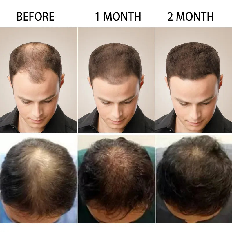 Sérum de traitement pour cheveux et cuir chevelu PURC
