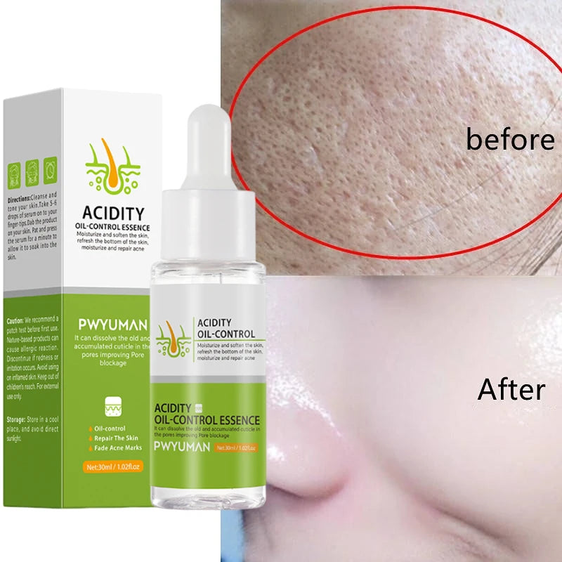 PWYUMAN Pore Minimizing Removing Tightening Facial Moisturizing Skin Essence Serum 30 ml