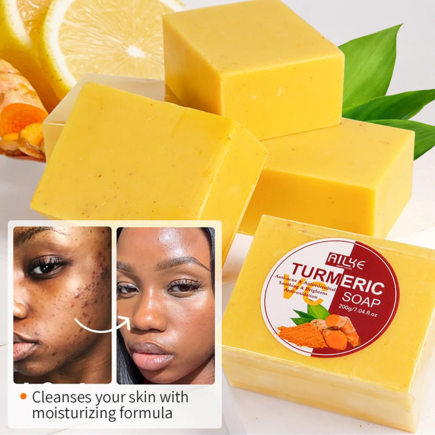 Coffret de soins de la peau au curcuma biologique AILKE - Traitement naturel éclaircissant et contre l'acné