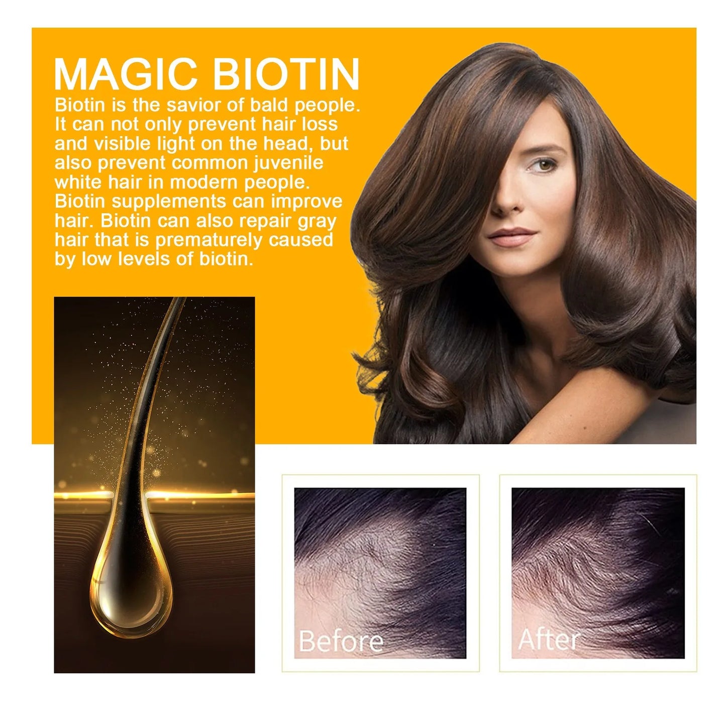 EELHOE Biotin Hair Growth Spray - Anti-Hair Loss Treatment for Scalp & Beard