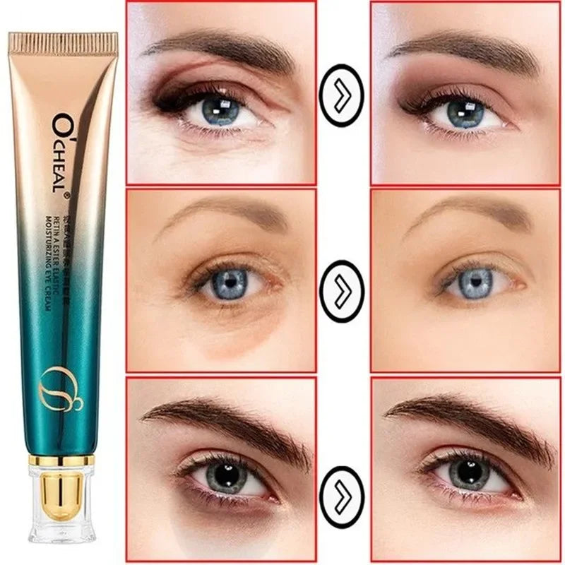 O'CHEAL Retinol Fade Anti Wrinkle Eye Cream