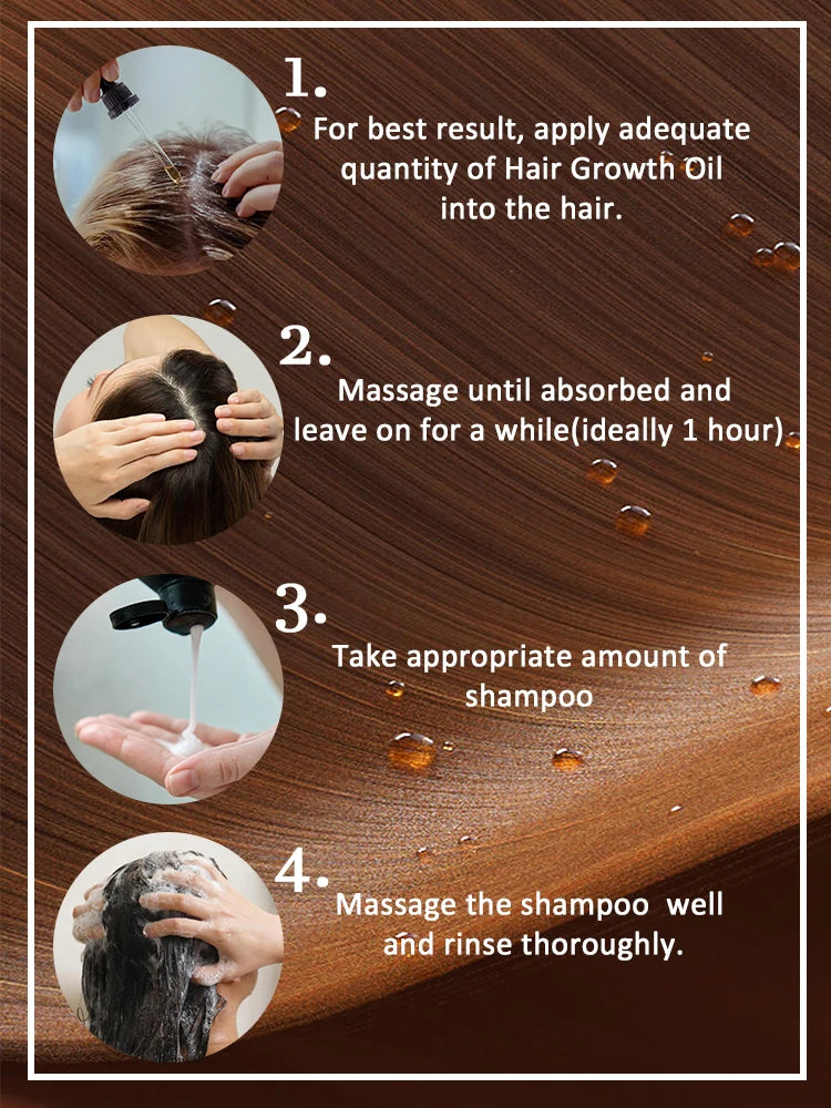 Unisex Haarwuchsöl Haarausfallbehandlung Schnelles Haarwachstum Effektive Haarausfallreparatur Erblicher postpartaler Haarausfall