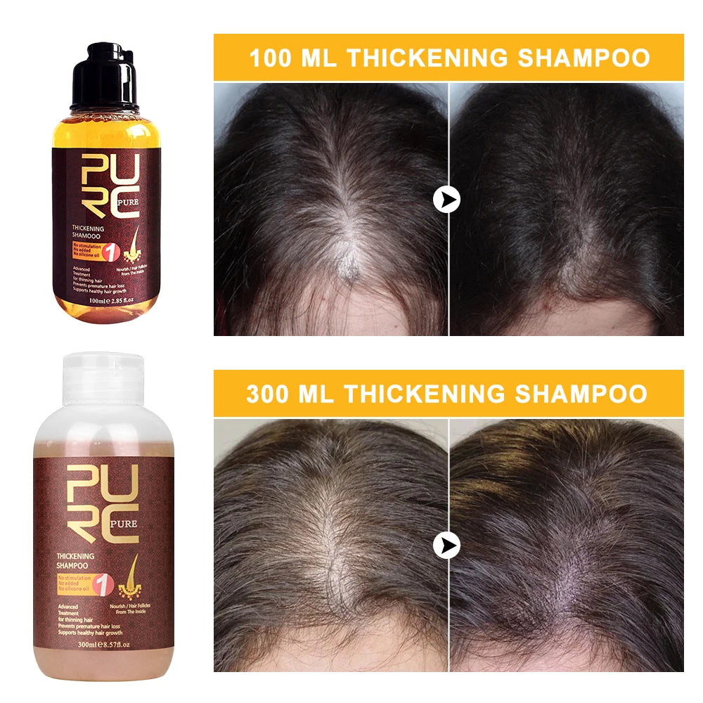 PURC Anti Hair Loss Fast Hair Growth Enhancing Biotin Ginger Treatment Shampoo 100/300 ml